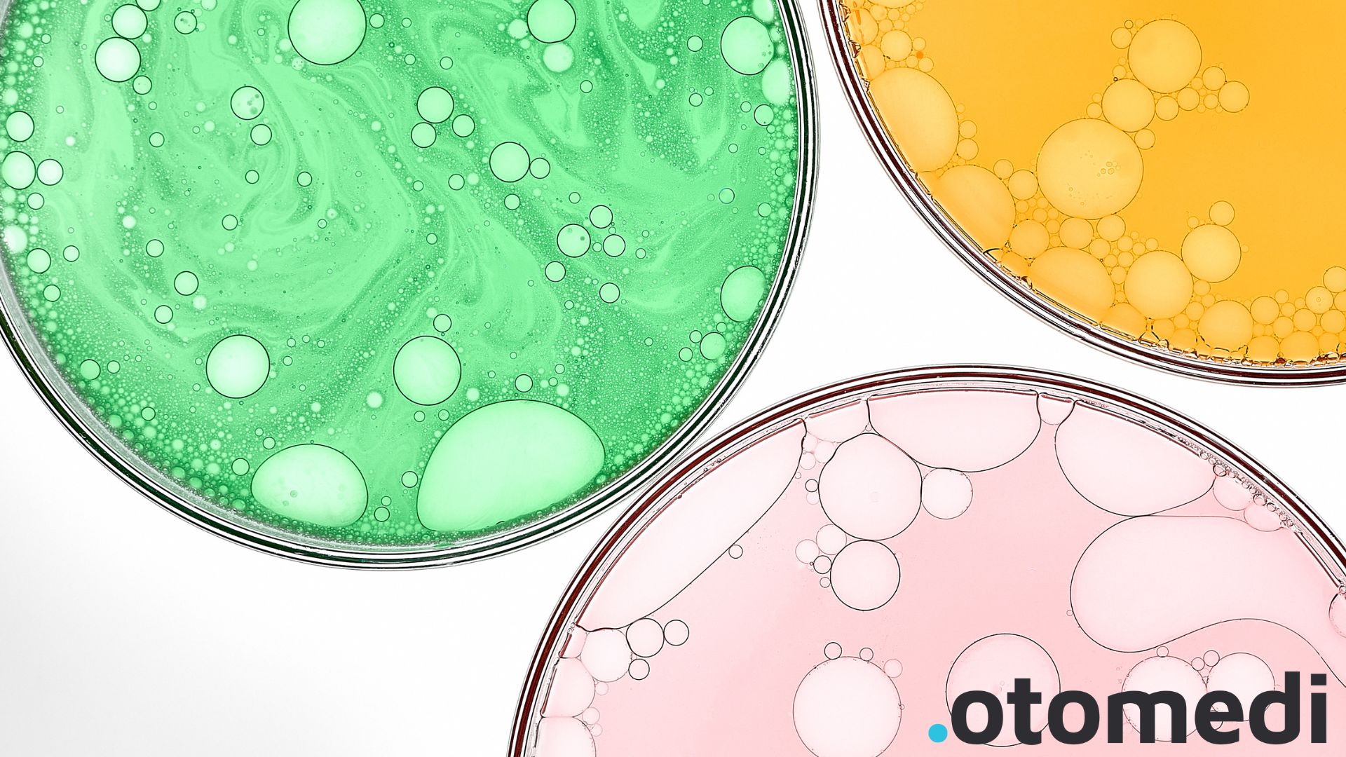 Zaburzenia neuroprzekaźników a dieta wysokoprzetworzona